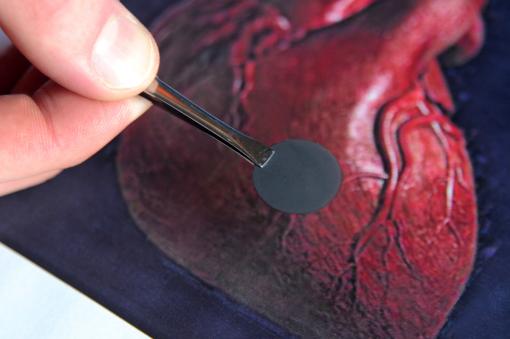 Beating heart - Engineers at Brown University have created a nanopatch for the heart that tests show restores areas that have been damaged, such as from a heart attack.
